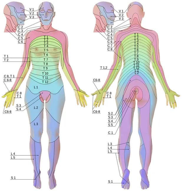 This is an anatomical illustration of human dermatomes showing anterior and posterior views in a female. Imaging modality: digital schematic diagram; technique: color-coded segmentation of cutaneous nerve territories mapped to spinal roots (C1–C8, T1–T12, L1–L5, S1–S5) with V1–V3 referenced around the head and neck. The front and back views reveal bilateral, overlapping dermatome bands that color gradient from light to dark to emphasize boundaries. Regions covered include the face (trigeminal V1–V3), neck, chest, abdomen, pelvis, upper and lower limbs. The torso shows thoracic dermatomes arranged in horizontal belts; the lumbar and sacral dermatomes extend into the hips, legs, and feet. Boundaries are schematic rather than exact anatomical demarcations, suitable for educational use. Pathophysiology implied includes sensory innervation by dorsal rami and ventral rami of spinal nerves; typical clinical relevance includes localization of neurologic deficits such as radiculopathy, herpes zoster reactivation along a dermatomal pattern, and planning of regional nerve blocks or sensory testing. This image supports medical education, anatomy review, clinical neurology practice, dermatology reference, and research on somatosensory mapping. Source attribution: Wikimedia Commons, Goran Tek-en, CC BY-SA 4.0; a freely available teaching resource. Users may print for classroom handouts or integrate into digital atlases and curricula for clinical training.