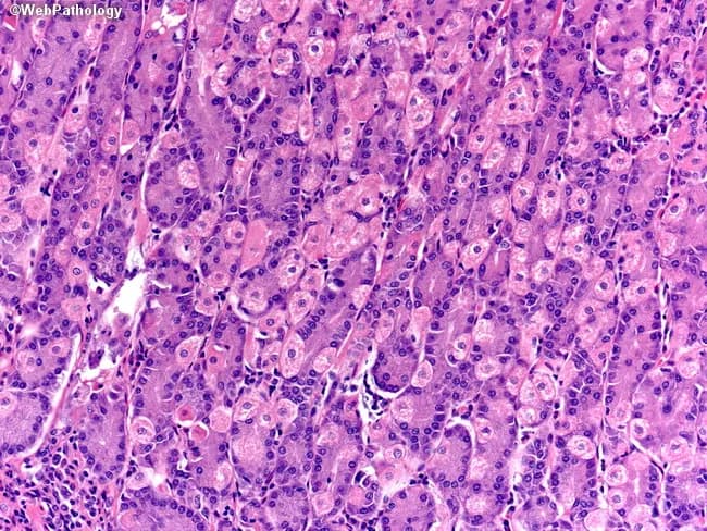 Gastric mucosal histology viewed by bright-field light microscopy on a Hematoxylin and Eosin (H&E) stained section of mucosa from the stomach, typically the oxyntic/fundic region. The glands are tubular and packed with two principal cell types: parietal (oxyntic) cells and chief (peptic) cells. Parietal cells display abundant eosinophilic (pink) cytoplasm and a central or slightly eccentric nucleus, giving a characteristic fried-egg appearance; they contribute acid secretion via gastric H+/K+-ATPase. Chief cells have basophilic (purple) cytoplasm with basal nuclei and apical zymogen granules, reflecting pepsinogen production. Neuroendocrine cells are present in minute numbers and are usually inconspicuous on routine H&E sections. Stem cells are scarce and not readily visible without special markers. The overall architecture shows intact gastric fundic glands with uniform cell density, minimal cytologic atypia, and preserved mucosal layering. The image emphasizes contrasts between cytoplasmic staining: eosinophilic parietal cells versus basophilic chief cells, as well as the densely staining nuclei. This morphology is essential for recognizing normal gastric mucosa, distinguishing parietal cell-rich areas, and identifying early metaplastic changes or inflammatory patterns in gastritis. Clinically, such images support reports of gastric biopsy evaluation, autoimmune gastritis assessment, and correlating acid-secreting cell distribution with disorders of digestion and nutrition and metabolic balance.