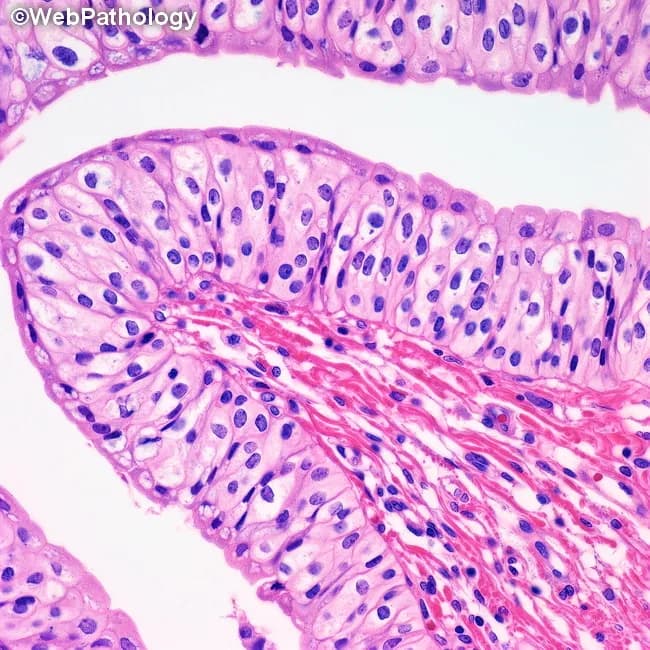 This is a histopathology image obtained by light microscopy of an H&E-stained small intestinal mucosa biopsy. The specimen shows finger-like villi projecting from the mucosal surface, consistent with the mucosa of the small intestine (duodenum/jejunum). The epithelium comprises tall absorptive enterocytes with basally oriented nuclei and interspersed goblet cells. The brush border is variably visible at higher magnification. The lamina propria beneath the epithelium contains loose connective tissue with capillaries and scattered inflammatory cells, and the muscularis mucosae is not clearly seen in this field. The villi retain architecture with uniform height; crypts are not prominent in this field; no villous blunting or crypt hyperplasia is evident. Overall, the mucosal architecture appears preserved without acute inflammatory infiltrates, edema, or necrosis. These features are typical of normal or non-inflammatory small intestinal mucosa. Clinically, such images are used to illustrate baseline histology in education, to compare with pathologies (celiac disease with villous atrophy, inflammatory enteropathy, Giardia infection). Diagnostic significance: confirms normal mucosal histology when clinical suspicion of malabsorption or inflammatory disease is low. Potential use cases include teaching, quality control of biopsy processing, and reference for comparison in gastroenterology research. This image serves as a reference standard for educational and diagnostic practice.