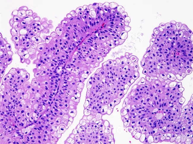 Brightfield hematoxylin and eosin stained histology slide of the small intestinal mucosa. The specimen shows finger-like villi lined by a simple columnar epithelium with scattered goblet cells producing mucin. Enterocytes display basally located nuclei and a dense cytoplasmic border, consistent with healthy absorptive cells. The lamina propria beneath the epithelium contains loose connective tissue and capillaries, and crypts of Lieberkühn appear at the bases of the villi with orderly architecture. Overall mucosal structure is preserved, with villous height and crypt organization within normal limits and no overt inflammatory infiltrate observed in this field. The image emphasizes epithelial surface details, goblet cell distribution, and intercrypt tissue patterns, making it an excellent reference for teaching normal intestinal histology and for contrast with pathological states. The magnification highlights mucosal architecture rather than deeper submucosa. Clinically, this specimen provides a baseline for malabsorption workups, educational comparisons with enteropathies such as celiac disease or infectious enteritis, and a reference standard for histological teaching. It supports differential diagnosis considerations, histologic correlation with serology, and radiologic-pathologic concordance in gastroenterology practice. This image is suitable for medical students, residents, and researchers studying basic histology, mucosal immunology, and nutrient absorption, and it can anchor discussions of normal variant goblet cell distribution across intestinal segments.
