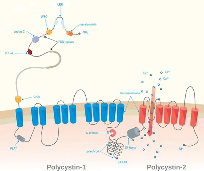 Comprehensive educational illustration showing the molecular architecture of autosomal dominant polycystic kidney disease (ADPKD). This schematic depicts two key PKD gene products, polycystin-1 (polycystin-1) and polycystin-2 (polycystin-2), embedded in the surface membranes of renal tubular epithelial cells and within the primary cilium. The image emphasizes that PKD1 mutations (chromosome 16p13.3) and PKD2 mutations (chromosome 4q21) disrupt a calcium-regulated signaling complex, leading to dysregulated tubular cell proliferation and cystogenesis. The left side highlights polycystin-1 features, including extracellular domains and transmembrane segments, while the right side shows polycystin-2 as a calcium-permeable ion channel. The transmembrane linkage and cytosolic signaling components suggest how altered calcium homeostasis influences downstream pathways governing cell adhesion, polarity, and fluid secretion. The illustration conveys the concept of haploinsufficiency with somatic second-hit events required for cyst formation, consistent with autosomal dominant inheritance with variable expressivity and high penetrance by age decades. Though clinically heterogeneous, patients commonly present with bilateral renal cysts, progressive loss of function, hypertension, and possible extrarenal manifestations. Used for genetics education, biomedical research, and training in molecular renal pathophysiology. The image also supports conceptual learning of gene dosage effects, allelic heterogeneity, and genotype-phenotype correlations essential for genetic counseling, risk assessment, and targeted molecular therapies in nephrology practice.