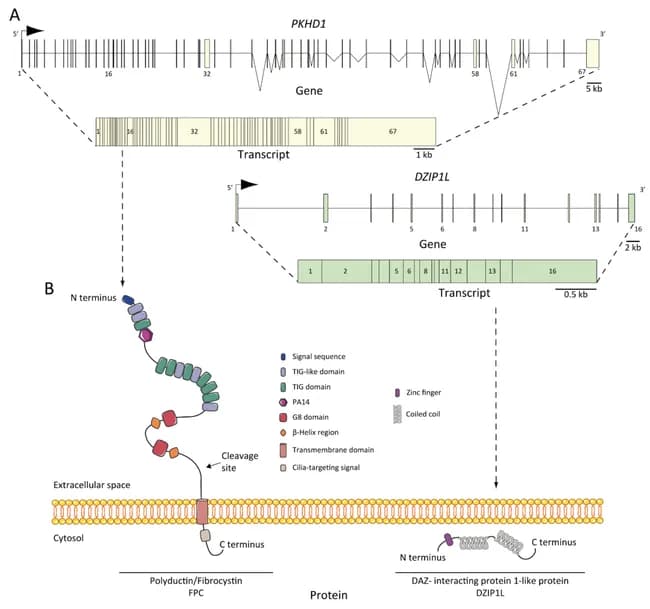 Genetic/genomic illustration detailing autosomal recessive polycystic kidney disease (ARPKD) genetics, with emphasis on PKHD1 and DZIP1L gene architecture. The image portrays the PKHD1 locus on chromosome 6p12, including gene structure, exons, and transcript organization, alongside a schematic depiction of the fibrocystin/polyductin (FPC) protein and its membrane-spanning and cytoplasmic domains. It also shows the DAZ interacting protein 1-like (DZIP1L) gene and transcript, encoding the DZIP1L protein localized to the primary cilium. The diagram underscores inheritance: ARPKD follows autosomal recessive transmission, with unaffected parents and a 25% risk to siblings; the majority of cases arise from PKHD1 mutations, with over 300 reported variants. Truncating PKHD1 mutations predict severe, perinatal or neonatal disease, while missense variants are associated with milder phenotypes and extended survival. A subset of patients carries DZIP1L mutations, often resulting in a milder clinical course and reduced perinatal mortality. The illustration integrates exonic mapping, transcript lengths, and domain architecture to connect genotype to protein function and cystogenesis mechanisms. Clinically, this image supports genetic counseling, diagnostic test design, and interpretation of sequence variants; it informs differential diagnosis among polycystic kidney diseases and renal ciliopathies; it is a valuable educational resource for medical genetics, nephrology, pediatrics, and basic science research into kidney development and tubulogenesis.