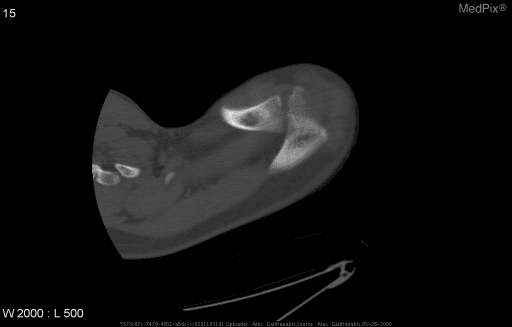 **Imaging Modality:** Computed Tomography (CT)
