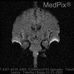 **Imaging Modality:** Magnetic Resonance Imaging (MRI); Diffusion-Weighted Imaging (DWI).