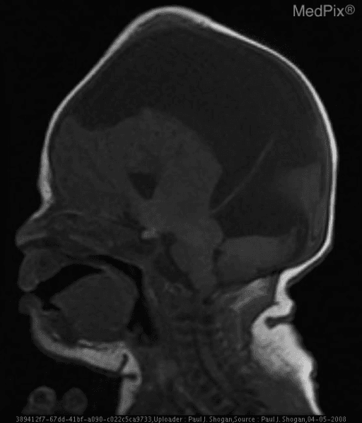 **Imaging Modality:** Sagittal T1-weighted Magnetic Resonance Imaging (MRI).