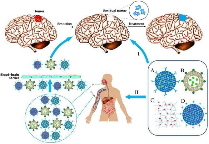 This medical illustration depicts therapeutic strategies for glioblastoma, focusing on drug and cell delivery methods following surgical resection. The diagram highlights two primary administration routes: (I) Local implantation, where therapeutic materials are applied directly into the resection cavity of the brain, bypassing the blood-brain barrier (BBB); and (II) Systemic administration, involving intravenous injection or oral delivery, where therapeutic agents must penetrate the BBB to reach residual tumor cells. The illustration classifies four types of biocompatible delivery materials: (A) Functionalized nanoparticles with surface ligands for targeted therapy; (B) Lipid nanocapsules or liposomes encapsulating active compounds; (C) A 3D hydrogel matrix or scaffold for structural support and localized release; and (D) Specialized nanoparticles, potentially incorporating immobilized cells or carrying specific surface charges. A timeline at the top shows the progression from tumor identification to resection, leaving residual tumor cells, and final treatment application. This schematic serves as an educational tool for neuro-oncology and pharmacology, demonstrating advanced drug delivery systems designed to overcome physiological barriers in brain cancer treatment.