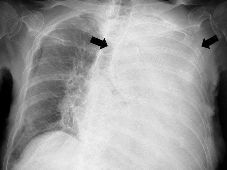 Hugging Face pmc clinical VQA raw