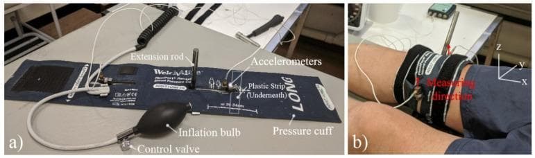 This procedural image illustrates a prototype diagnostic device designed for vibration-based assessment of bone stiffness and fracture healing. Figure (a) displays the device components: a standard inflatable pressure cuff integrated with a metal extension rod, two accelerometers, a plastic reinforcement strip, and an inflation bulb with a control valve. Figure (b) demonstrates the clinical application of the device on a human participant. The pressure cuff is secured around the distal femur, proximal to the knee joint. The accelerometers are positioned over the medial and lateral epicondyles to capture the modal response of the bone. A coordinate system indicates the 'Measuring direction' in the anterior-posterior orientation (positive z-direction). This setup is used to quantitatively measure the bone's vibration response to a mechanical impulse (e.g., from an impact hammer), providing a radiation-free, non-invasive method for monitoring orthopedic recovery. The focus is on orthopedic diagnostic technology and musculoskeletal biomechanics.