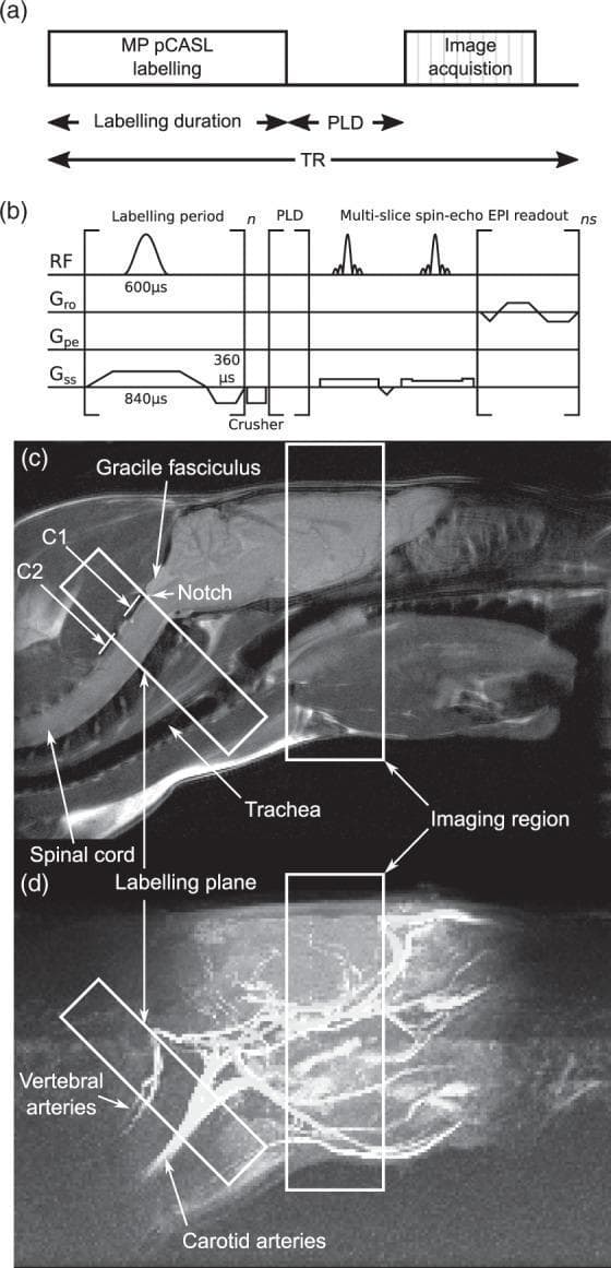 This four-panel figure illustrates a multiphase pseudo-continuous arterial spin labeling (pCASL) MRI protocol. (a) A simplified sequence schematic showing labeling duration, post-labeling delay (PLD), and acquisition within the repetition time (TR). (b) A detailed pulse timing diagram displaying radiofrequency (RF) pulses and gradient waveforms (Gro, Gpe, Gss) for labeling and multi-slice spin-echo EPI readout. (c) A sagittal fast spin-echo anatomical midline image of a Sprague Dawley rat head used for planning. Labeled landmarks include the C1 and C2 vertebrae, spinal cord, trachea, and the gracile fasciculus with a caudal notch used as a reference for placing the 6.2 mm labeling plane. (d) A maximum intensity projection of time-of-flight (TOF) angiography of the same field of view. It highlights the major neck vessels, specifically the carotid and vertebral arteries, and their orientation relative to the labeling plane and intracranial imaging region. This visual material demonstrates the methodology for optimizing labeling efficiency by aligning the labeling plane perpendicular to straight vascular segments in preclinical neuroimaging.