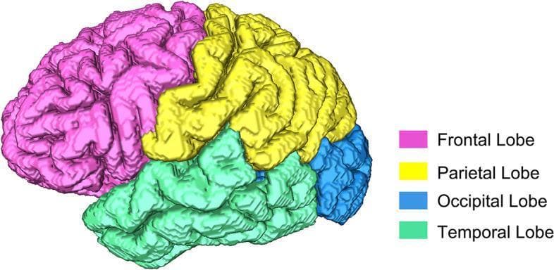 This diagnostic image provides a 3D lateral surface reconstruction of a human brain, derived from MRI data, highlighting cortical anatomy. The cerebral cortex is segmented into four primary lobes using a color-coding scheme: the frontal lobe is pink, the parietal lobe is yellow, the temporal lobe is green, and the occipital lobe is blue. The visualization emphasizes the complex patterns of gyri (elevated ridges) and sulci (grooves) that define human neuroanatomy. Visible landmarks include the central sulcus, which demarcates the frontal and parietal lobes, and the lateral fissure (Sylvian fissure), which separates the temporal lobe from the overlying frontal and parietal regions. This type of segmented anatomical diagram is used in clinical imaging research, such as the MIRIAD database studies, to quantify morphological changes like cortical tortuosity, atrophy, or surface area variations in neurodegenerative conditions such as Alzheimer’s disease. The reconstruction serves as a teaching tool for neuroanatomy and as a reference for volumetric and surface-based brain analysis.