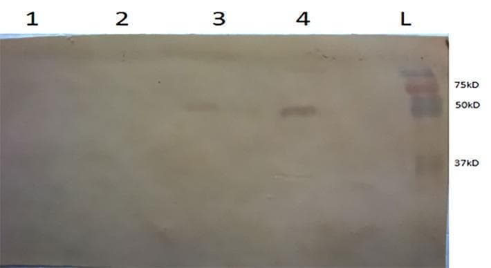 This diagnostic laboratory image displays a Western blot assay used to detect the expression of the NAHSP70 protein. The blot contains five lanes: Lanes 1 and 2 show no detectable bands, representing non-transfected cells and a negative control. Lane 3, containing culture supernatant, and Lane 4, containing infected Sf9 cell lysate, both exhibit target protein bands located between the 50 kDa and 75 kDa markers. Lane 4 shows higher band intensity compared to Lane 3, and a secondary faint band near 37 kDa. Lane L contains a prestained protein ladder with prominent molecular weight markers at 75 kDa, 50 kDa, and 37 kDa. This image serves as a molecular biology illustration of protein expression and purification verification using baculovirus expression systems, relevant for medical research in heat shock proteins and recombinant vaccine production.
