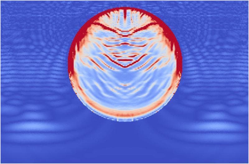 This pathophysiology diagram is a computational visualization using the Material Point Method (MPM) to simulate the effects of Extracorporeal Shock Wave Lithotripsy (ESWL) on a kidney stone. The image depicts a circular, single-phase kidney stone immersed in a fluid medium (modeled as water) at the moment a high-pressure shock wave has reached the end of the stone. The fluid medium displays stress waves as concentric, blue-toned undulating ripples propagating through the domain. Within the stone, damage accumulation is color-coded: red indicates areas of complete failure, while lighter blue and white areas represent internal stress and emerging fractures. Significant damage is concentrated at the proximal side (top) where the wavefront first impacted, showing a thick layer of failure. Distinct angled failure lines extend from the stone's edges toward the center, representing shear stress interactions. Minor damage and tensile fractures are also visible at the distal end (bottom) of the stone, resulting from internal wave reflections and interference patterns. This simulation serves as an educational model for understanding fragmentation mechanisms in urolithiasis treatment.