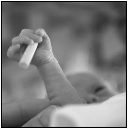 This grayscale clinical photograph depicts the palmar grasp reflex in a preterm infant. The focus is on the infant's hand and forearm as it securely grips a small, smooth cylindrical object. The infant's fingers are flexed around the cylinder, demonstrating the tactile and motor response characteristic of the primitive grasp reflex. The cylinder, approximately 35 mm in length and 6 mm in diameter, is positioned within the palm, with the distal end protruding. In the blurred background, the infant's face is partially visible, indicating the neonatal clinical setting. This image serves as an educational tool for neonatal development, illustrating haptic perception and sensorimotor coordination in premature newborns. It is particularly relevant for pediatric and neonatal research focusing on the maturation of the central nervous system and the evaluation of primitive reflexes as indicators of neurological health.