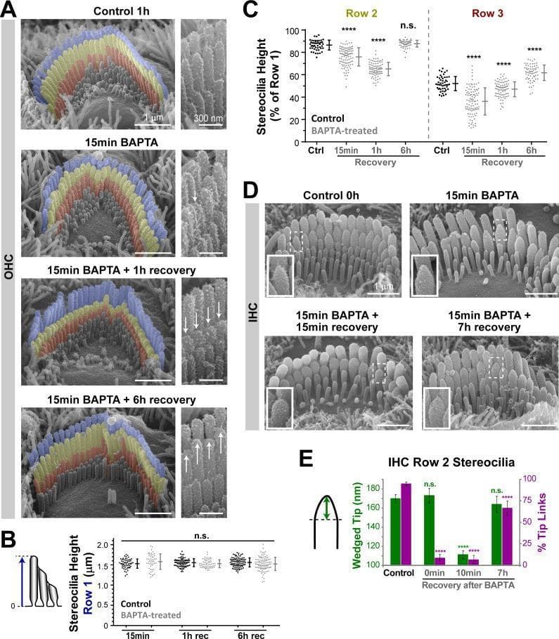 This composite educational graphic features scanning electron microscopy (SEM) images and corresponding quantitative plots illustrating the structural remodeling of hair cell stereocilia in the mouse organ of Corti.
Panel A displays false-colored SEM images of outer hair cell (OHC) bundles across four states: control, immediately following BAPTA treatment (disrupting tip links), and during 1-hour and 6-hour recovery periods. The images demonstrate selective shortening of the shorter stereocilia rows (Row 2 and Row 3) after BAPTA exposure, followed by regrowth during recovery, while the tallest row (Row 1) remains stable. High-magnification insets use arrows to highlight these morphological changes.
Panels B and C provide dot plots quantifying absolute heights of Row 1 and relative heights of Rows 2 and 3, statistically confirming that shortening is limited to transducing rows. Panels D and E show inner hair cell (IHC) bundles, highlighting the transformation of stereocilia tips from a 'wedged' morphology to a rounded shape following BAPTA treatment, with eventual restoration of the wedge shape upon tip link regeneration. These findings illustrate the role of mechanotransduction (MET) current and calcium signaling in maintaining hair bundle architecture.