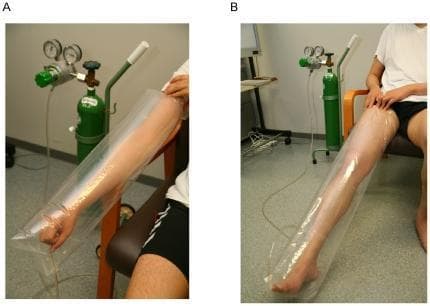 Clinical procedural photograph demonstrating a novel system for the transcutaneous delivery of carbon dioxide (CO2) gas. Figure A shows the application to a human upper limb, where the arm is enclosed within a transparent, airtight plastic adaptor. Figure B illustrates the application to a lower limb, with the leg from mid-thigh to foot similarly sealed. In both setups, a green compressed gas cylinder containing pure CO2 is connected to the adaptor via flexible tubing. The system utilizes pressure regulators and gauges to control gas flow into the enclosed space. The clinical objective shown is to facilitate CO2 absorption through the skin, typically used in research studying microcirculation, tissue oxygenation, and Bohr effect-mediated oxygen dissociation from hemoglobin. The setup demonstrates a non-invasive method for local gas therapy in human subjects.