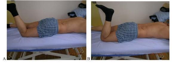 This clinical photograph set demonstrates the 'Prone Lying Active Knee Flexion' test, a movement control assessment for the lumbar spine and pelvis. Image A (left) displays the correct performance of the test: the subject is prone, actively flexing the knee toward 90 degrees while maintaining a neutral, stable lower back and pelvis without rotational compensation. Image B (right) illustrates a positive/incorrect finding: as the knee flexes, there is observable anterior tilting or rotation of the pelvis and lumbar spine, indicating poor segmental stabilization and movement dysfunction. This diagnostic protocol, based on Sahrmann and O'Sullivan criteria, is utilized in physical therapy and orthopedics to evaluate rotational control of the lumbopelvic region. The comparison highlights how regional interdependence between the hip and lumbar spine can manifest as compensatory movement patterns in patients with low back pain or instability.