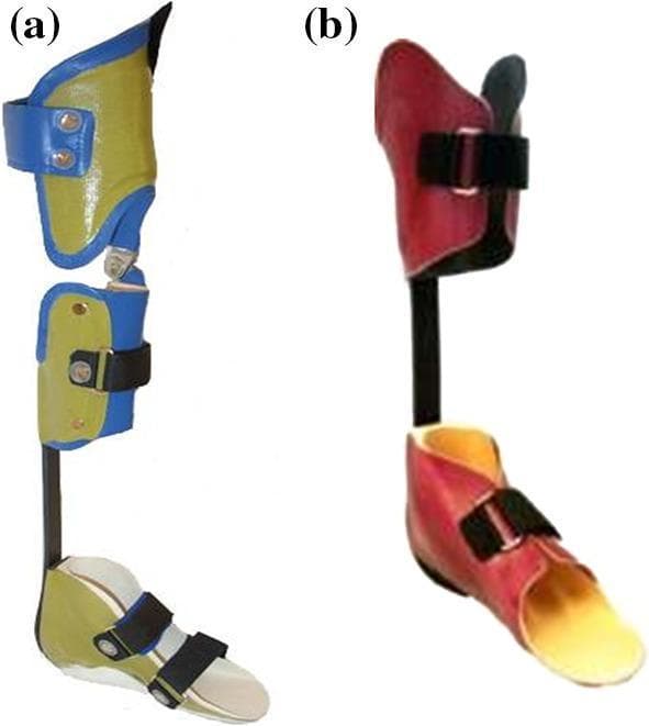 This clinical photograph displays two types of carbon fiber spring orthoses used in pediatric gait rehabilitation. Image (a) depicts a Knee-Ankle-Foot Orthosis (KAFO) featuring a tri-level system with a thigh cuff, a shank cuff, and a footplate. The cuffs are constructed from yellow thermoplastic with blue reinforced edging and integrated mechanical hinges to allow controlled sagittal knee movement. A rigid posterior bar, likely carbon fiber, connects the shank to the foot section. Image (b) shows an Ankle-Foot Orthosis (AFO-C) consisting of a proximal calf cuff and a distal footplate joined by a vertical carbon fiber spring shank. The AFO-C uses red molded thermoplastic with black Velcro strap closures and a low-profile footplate designed for energy storage and push-off assistance. These devices are indicated for conditions like Arthrogryposis Multiplex Congenita (AMC) to stabilize joints and enhance lower limb kinematics during the stance and swing phases of gait.
