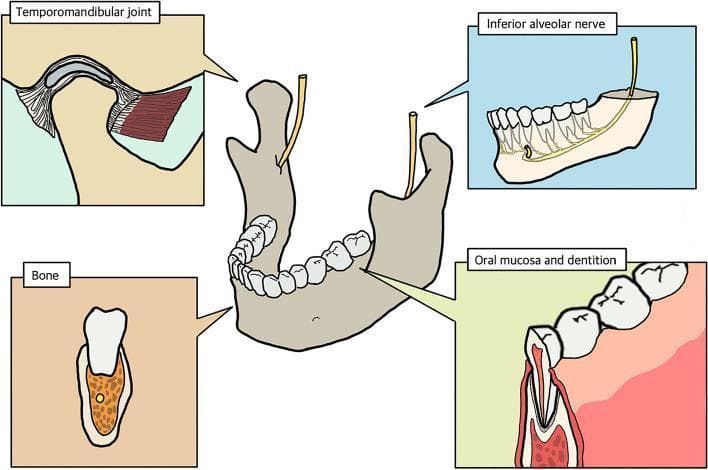 This medical anatomical diagram illustrates the composite tissue anatomy of the human mandible, intended for 3D bio-printing and surgical reconstruction planning. The central figure shows a horseshoe-shaped mandible with superior dentition and the emerging inferior alveolar nerves. Four inset boxes provide detailed structural views: 1) The 'Temporomandibular joint' panel displays the condylar articulation, articular disk, and associated ligaments and muscle attachments. 2) The 'Inferior alveolar nerve' panel shows the nerve's longitudinal pathway through the mandibular canal, providing innervation to tooth roots. 3) The 'Oral mucosa and dentition' panel depicts a cross-section of a tooth, including enamel, pulp chamber, and its anchor within the gingival tissue. 4) The 'Bone' panel illustrates the parenchymal bone frame in cross-section, highlighting the cortical shell and the internal trabecular/cancellous bone pattern. This diagram serves as an educational resource for understanding the multi-tissue complexity required in maxillofacial regenerative medicine and segmental defect reconstruction.