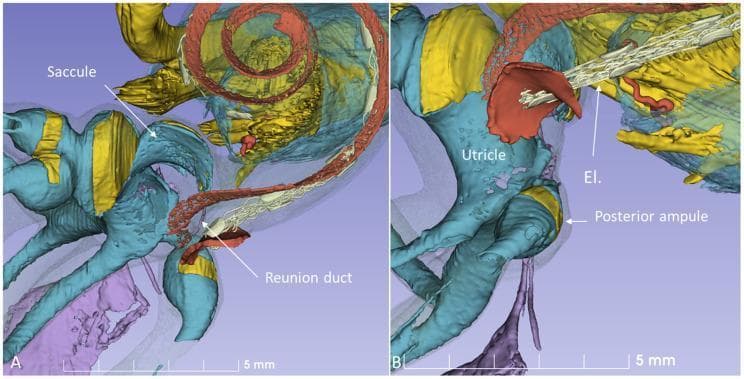 This medical visual comprises two panels (A and B) featuring high-magnification 3D reconstructions of the human inner ear's membranous labyrinth, derived from micro-CT imaging. Panel A highlights the surgical anatomy of the cochlear base, demonstrating the saccule (yellow pouch-like structure) and its connection via the reunion duct (RD, white tubular structure) to the cochlea (reddish spiral). The spatial relationship emphasizes the proximity of the saccule to the surgical pathway. Panel B illustrates a virtual cochlear implant surgery using a round window (RW) approach. A cochlear implant electrode (El, white segmented structure) is shown inserted into the cochlea, passing near the utricle (red) and the posterior ampulla (yellow). The supporting bony and soft tissues are rendered in blue and purple hues. The images serve as educational models to visualize anatomical risks during electrode insertion, specifically the close distances between the round window and vestibular receptors like the saccule and posterior ampulla nerves.