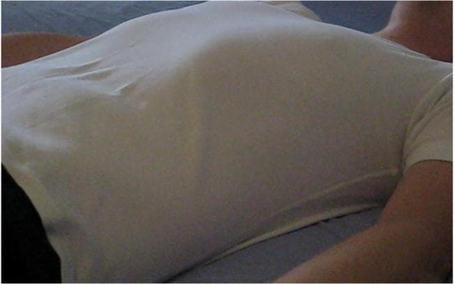 A clinical photograph of a human subject in a supine position, focused on the thorax and neck. The individual is wearing a loose-fitting white t-shirt against a dark background. This visual serves as a standardized pedagogical tool for assessing respiratory patterns and calculating respiratory rate (RR). The image captures the rise and fall of the chest wall and abdominal excursions, which are critical visual cues for clinical observation in emergency medicine and nursing education. The setup is designed to teach healthcare professionals how to identify tachypnea, bradypnea, or normal breathing rhythms (eupnea) through non-invasive visual inspection of the thoracic region. By highlighting the contour of the chest against the fabric, the image facilitates the identification of respiratory effort and chest wall symmetry.