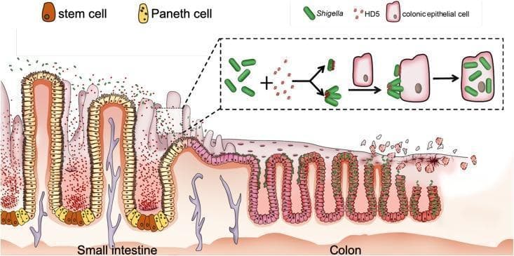 This pathophysiology diagram illustrates the proposed mechanism by which human alpha-defensin 5 (HD5) promotes Shigella infection in the colonic epithelium. The visual is divided into two main sections: the small intestine and the colon. In the small intestine section, the epithelium is characterized by long villi containing stem cells (brown) and Paneth cells (yellow) at the crypt bases. Paneth cells are shown secreting HD5 (red dots) into the intestinal lumen, where they encounter rod-shaped Shigella bacteria (green). A detailed inset shows the molecular interaction: HD5 binds to the bacterial surface, acting as a molecular bridge or causing bacterial clustering to enhance adhesion. In the colon section, the epithelium transitions to a flatter structure with shorter crypts. The HD5-coated Shigella are depicted adhering to the apical surface of colonic epithelial cells (pink), followed by cellular invasion and intracellular replication. The rightmost portion of the diagram shows resulting tissue damage, epithelial sloughing, and loss of mucosal integrity, highlighting the clinical significance of defensins as unintended facilitators of bacterial pathogenicity in certain gastrointestinal infections.