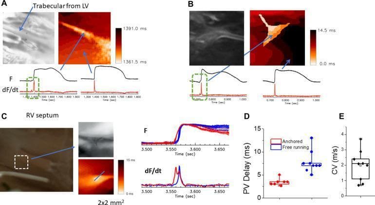 Educational panel illustrating cardiac electrophysiology and optical mapping of the Purkinje-ventricular junction (PVJ) in rabbit heart models. The figure is divided into five sections (A-E). Panels A, B, and C present side-by-side anatomical grayscale/brightfield images, color-coded activation maps, and corresponding action potential traces (F) with their first derivatives (dF/dt). These panels demonstrate conduction in the trabecular muscle of the left ventricle (A), free-running Purkinje fibers (B), and the right ventricular (RV) septum involving papillary muscle (C). A key educational feature is the visualization of 'step-delays' in the dF/dt traces—highlighted by green dotted boxes—showing dual upstrokes that represent the temporal separation between Purkinje fiber activation and ventricular muscle activation. Panel D provides a comparative dot plot of Purkinje-ventricular (PV) delay in milliseconds, distinguishing between 'anchored' (shorter delay) and 'free-running' (longer delay) fibers. Panel E is a box-and-whisker plot displaying the conduction velocity (CV) along Purkinje fibers, measured in meters per second (m/s). This resource illustrates how the specialized conduction system coordinates rapid, sequential electrical activation within the ventricular myocardium.