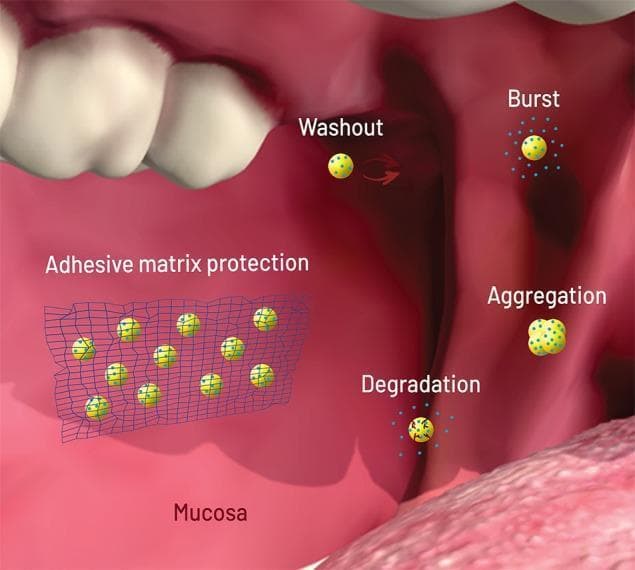 This medical illustration depicts the pharmacokinetics and failure modes of drug-loaded nanoparticles (NPs) within the oral cavity environment. The background features anatomical structures of the mouth, including teeth, tongue, and the pink mucosal surface. Nanoparticles are represented as yellow spheres containing blue dots, which signify the loaded drug. The diagram illustrates four primary failure modes: 'Washout' (removal of NPs from the site by saliva flow), 'Burst' (uncontrolled rapid drug release upon contact with saliva), 'Aggregation' (clumping of individual NPs into larger, less effective complexes due to pH or protein binding), and 'Degradation' (physical breakdown of the carrier by enzymes or acidic pH). On the left, 'Adhesive matrix protection' is demonstrated, showing a blue net-like polymer matrix adhered to the mucosa. This matrix serves as a protective delivery system, physically shielding the nanoparticles from external stressors to eliminate or reduce the aforementioned failure modes. This content is relevant for pharmacology and dental students focusing on advanced drug delivery systems and buccal drug administration strategies.