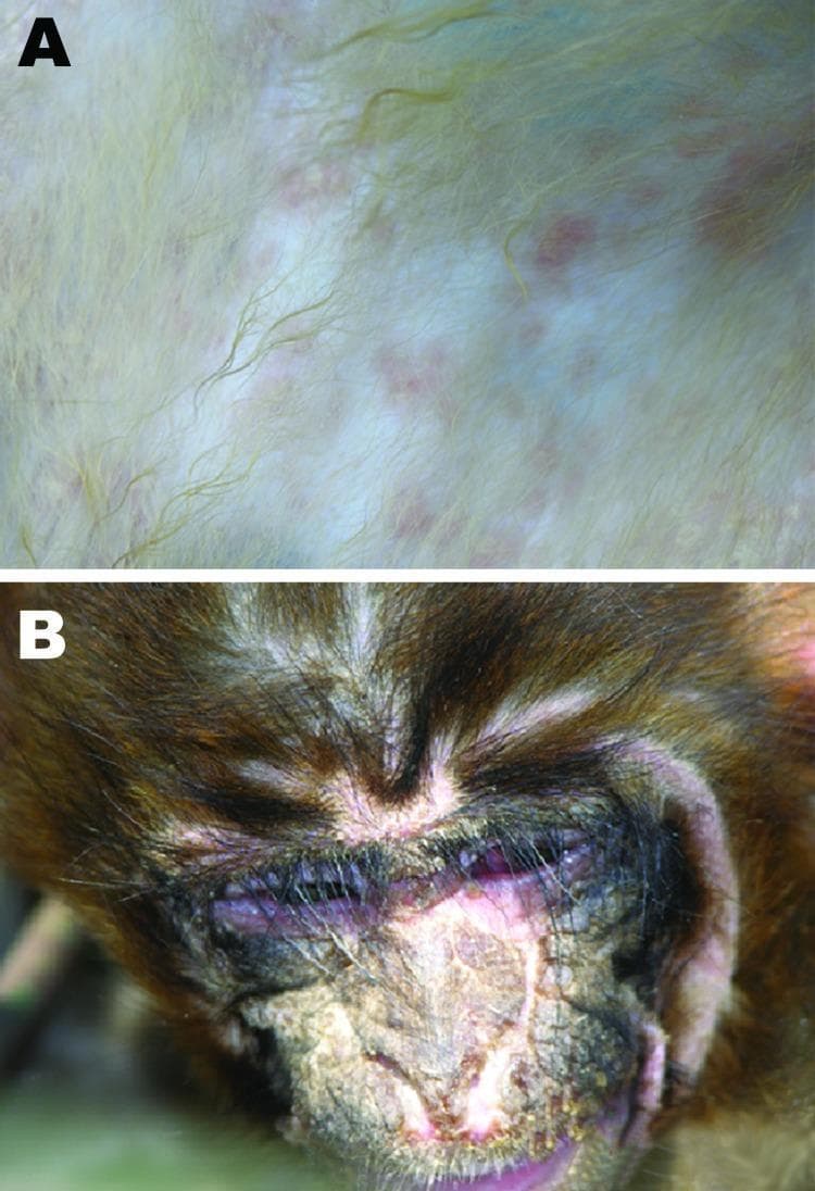 Two-panel clinical photograph illustrating the manifestations of Canine Distemper Virus (CDV) in a rhesus monkey specimen, serving as a non-human primate model for viral pathogenesis. Panel A shows a close-up of the integumentary system, demonstrating a maculopapular rash. The rash consists of discrete, rosy to purple macules approximately 2–4 mm in diameter, distributed across the pale skin beneath the fur. Panel B illustrates severe ocular and facial involvement. Notable findings include suppurative conjunctivitis with thick purulent exudate matted in the fur and eyelids, significant periorbital inflammation, and ulcerated, crusting lesions on the nasal bridge and perinasal skin. These clinical signs reflect the systemic and epithelial tropism of the virus, mimicking human measles-like symptoms. The image is used in medical pathology to highlight cross-species viral transmission and clinical diagnostic signs of paramyxovirus infections.