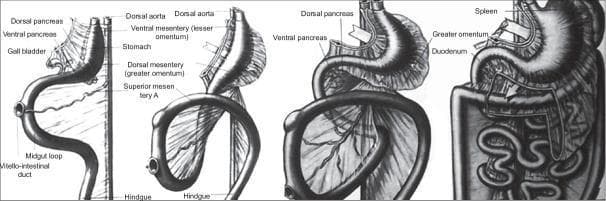 Anatomical diagram illustrating the embryological development of the foregut and midgut, specifically focusing on the dorsal mesoesophagus, mesogastrium, and stomach ligaments. The illustration series shows the evolution of the gastrointestinal tract across four stages. Key visible structures include the dorsal aorta, the stomach, and the primary intestinal loop consisting of the midgut loop and vitello-intestinal duct. Developmental landmarks such as the dorsal and ventral pancreas buds, gall bladder, and spleen are shown in their respective anatomical positions. The diagram highlights the transformation of the mesenteries: the ventral mesentery (lesser omentum) and the dorsal mesentery (greater omentum). The latter is depicted as it expands to encapsulate the superior mesenteric artery and eventually forms the omental bursa and complex peritoneal folds. In the later stages, the diagram demonstrates the rotation of the stomach, the elongation of the duodenum, and the final spatial organization of the spleen and pancreas within the posterior abdominal wall context.