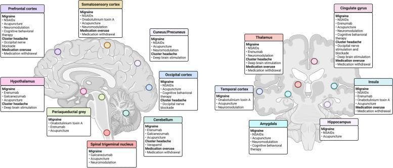 An anatomical diagram illustrating two schematic views of the human brain—a medial sagittal section (left) and a coronal section (right)—mapping the neuroanatomical targets for headache treatments. The illustration utilizes a color-coded system to link specific brain regions to their clinical relevance in migraine, cluster headache, and medication overuse headache management. Key areas identified in the sagittal view include the prefrontal cortex, somatosensory cortex, cuneus/precuneus, occipital cortex, hypothalamus, periaqueductal gray (PAG), spinal trigeminal nucleus, and cerebellum. The coronal view highlights the cingulate gyrus, thalamus, insula, temporal cortex, hippocampus, and amygdala. Each region is associated with specific therapeutic modalities mentioned in clinical literature, such as NSAIDs, monoclonal antibodies (Erenumab, Galcanezumab), onabotulinum toxin A, neuromodulation, and deep brain stimulation. This infographic serves as a pedagogical summary of the central nervous system structures involved in headache pathophysiology and the spatial distribution of pharmacological and interventional treatment targets.