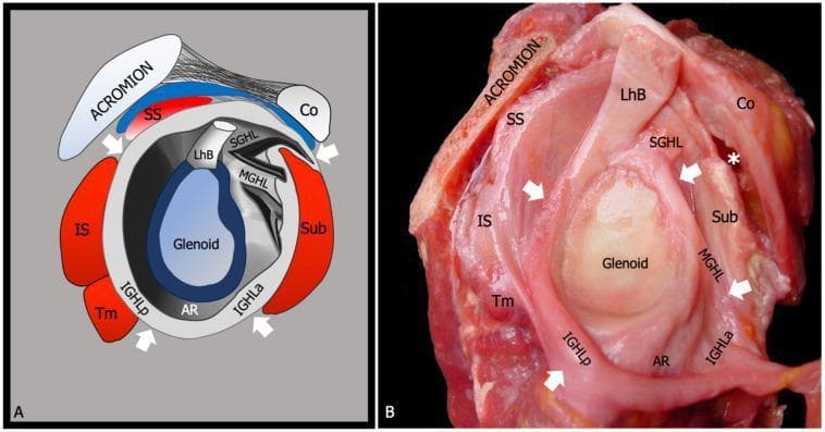 This dual-panel image provides a side-by-side comparison between a schematic anatomical diagram (A) and a gross anatomic dissection (B) of the human glenohumeral joint, viewed from a lateral perspective with the humeral head removed. The focus is on the glenohumeral joint capsule and its relationship with the rotator cuff. Key anatomical landmarks identified include the glenoid cavity, coracoid process (Co), acromion, and the long head of the biceps tendon (LhB). The capsule is illustrated as a continuous fibrous structure with focal thickenings representing the intrinsic glenohumeral ligaments: the superior (SGHL), middle (MGHL), and the anterior (IGHLa) and posterior (IGHLp) bands of the inferior glenohumeral ligament. The inferior redundant portion of the capsule, the axillary recess (AR), is clearly labeled. The surrounding rotator cuff tendons—supraspinatus (SS), infraspinatus (IS), teres minor (Tm), and subscapularis (Sub)—are shown in their respective superior, posterior, and anterior positions, demonstrating how they reinforce the joint capsule. This material serves as a baseline for understanding shoulder stability and the pathophysiology of adhesive capsulitis.