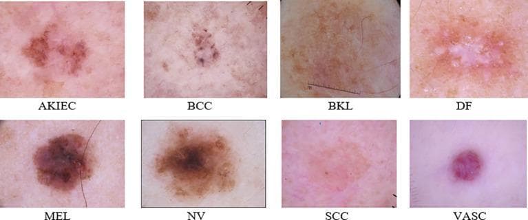 This clinical comparison chart presents eight dermoscopic images of various skin lesions, serving as an educational reference for dermatological classification. Each image represents a category from the ISIC 2019 dataset: Actinic Keratoses and Intraepithelial Carcinoma (AKIEC), Basal Cell Carcinoma (BCC), Benign Keratosis-like Lesions (BKL), Dermatofibroma (DF), Melanoma (MEL), Melanocytic Nevi (NV), Squamous Cell Carcinoma (SCC), and Vascular Lesions (VASC). The visual comparison highlights diagnostic morphological features, including the asymmetrical pigment distribution and irregular borders in MEL and NV, the translucent or pinkish hue with small dark spots in BCC, the central white area characteristic of DF, and the distinct reddish vascular structure in the VASC category. This figure is designed for medical students and clinicians to distinguish between malignant and benign skin tumors based on color variegation, textural patterns, and structural organization. It serves as a visual benchmark for training diagnostic algorithms and improving clinical accuracy in identifying high-level features associated with skin cancer.