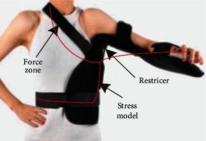 This clinical photograph and annotated diagram illustrate a custom-designed 3D-printed shoulder joint brace positioned on a patient. The medical device is a semi-rigid orthotic designed for orthopedic rehabilitation, specifically targeting rotator cuff imbalances or postoperative stabilization. The brace features three primary structural components: a horizontal torso strap for trunk stabilization, a diagonal shoulder strap for vertical support, and a distal forearm support section for limb immobilization and positioning. Red lines overlaid on the image delineate a 'Stress model' across the thoracic and upper extremity regions. Specific annotations identify the 'Force zone' at the superior shoulder/neck junction, a 'Restricter' mechanism at the glenohumeral joint to control range of motion, and a 'Stress model' at the lateral chest wall. The device integrates principles of dynamic and static Chinese orthopedic medicine to assist in the recovery of shoulder joint function and muscle torque balance between internal and external rotators.