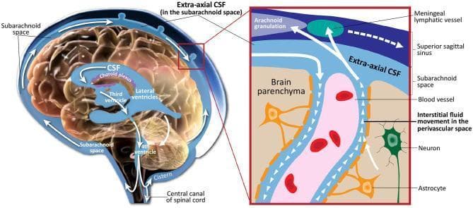 This medical illustration depicts the production, circulation, and absorption of cerebrospinal fluid (CSF) within the human central nervous system. The primary anatomical diagram shows a sagittal section of the brain, highlighting the ventricular system (lateral, third, and fourth ventricles) and the choroid plexus as the site of CSF production. White arrows indicate the flow from the ventricles into the brain cisterns and the subarachnoid space, where it is labeled as extra-axial CSF. A detailed inset focuses on the glymphatic-like interaction within the brain parenchyma. This close-up view shows the perivascular space surrounding a blood vessel, illustrating the movement of interstitial fluid and CSF exchange adjacent to neurons and astrocytes. The diagram further illustrates the primary drainage pathways into the superior sagittal sinus via arachnoid granulations and into the meningeal lymphatic vessels. This visual resource is designed for neurological and physiological education, emphasizing the dynamic nature of CSF and its critical role in metabolic waste clearance and intracranial pressure regulation.