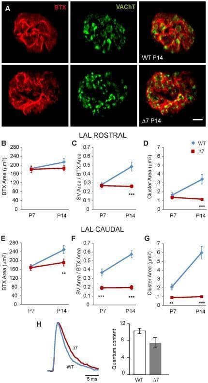This composite educational graphic details neuromuscular junction (NMJ) alterations in Spinal Muscular Atrophy (SMA) using a SMNΔ7 mouse model. Section A presents immunofluorescence images of motor terminals at postnatal day 14 (P14) in wild-type (WT) and SMNΔ7 mice. Postsynaptic acetylcholine receptors are labeled with Bungarotoxin (BTX-Rho, red) and presynaptic synaptic vesicles (SVs) with Vesicular Acetylcholine Transporter (VAChT, green). The images reveal that while postsynaptic morphology appears similarly mature and reticulated in both groups, the SVs in SMNΔ7 terminals exhibit abnormal clustering and reduced occupancy compared to the dispersed distribution in WT. Sections B–G provide quantitative line graphs comparing the levator auris longus (LAL) muscle's rostral and caudal divisions. These plots track mean postsynaptic area, SV area normalized to BTX area, and cluster area from P7 to P14. The data show significant developmental stagnation and reduction in SV parameters in the SMNΔ7 group, particularly in the caudal division. Section H includes representative endplate potential (EPP) traces and a bar graph of quantum content, illustrating functional synaptic transmission deficits in the mutant terminals.