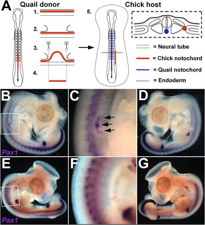 This composite educational material illustrates embryonic development and experimental embryology focusing on sclerotome patterning.