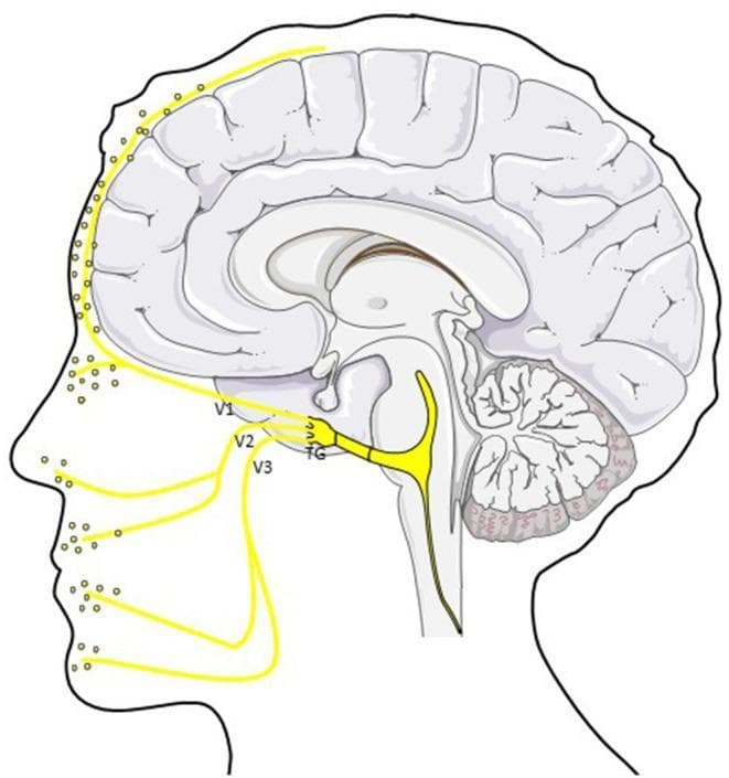 An anatomical diagram in sagittal profile illustrating the trigemino-vascular system and its role in migraine pathophysiology. The central focus is the trigeminal ganglion (TG), from which three primary divisions of the trigeminal nerve (CN V) emerge: the ophthalmic (V1), maxillary (V2), and mandibular (V3) branches. These peripheral afferents are shown innervating the scalp, forehead, mid-face, and jaw regions, with yellow dots indicating the release of Calcitonin Gene-Related Peptide (CGRP) at nerve terminals. Intracranially, the diagram highlights the ophthalmic division's (V1) innervation of the dura mater and cerebral vasculature. Centrally, a primary nerve tract is depicted traveling from the trigeminal ganglion toward the brainstem and trigeminocervical complex (TCC), representing the pathway for nociceptive signal transmission. The illustration combines a stylized mid-sagittal section of the human brain—including the cerebrum, cerebellum, and brainstem—with a facial outline to demonstrate the neuroanatomical connection between intracranial meningeal structures and peripheral facial sensory distribution.
