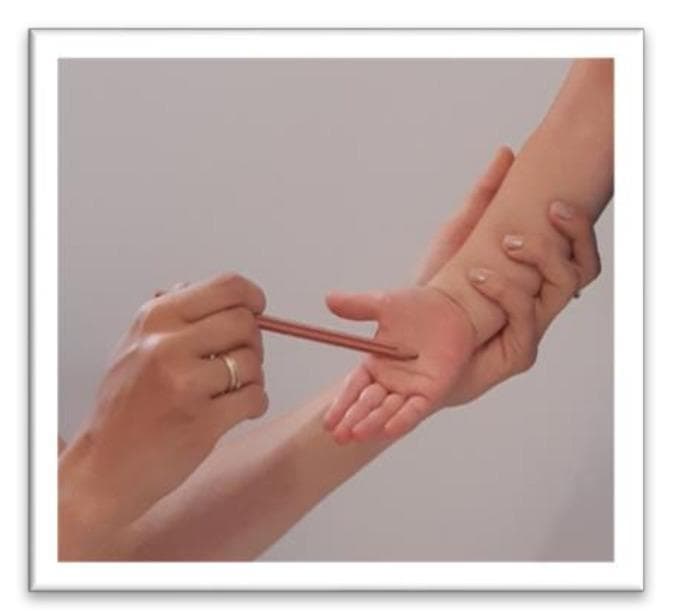 A clinical photograph illustrating the standardized testing procedure for the Palmar reflex (grasp reflex) on a child's right hand. The image depicts an examiner's hand securely stabilizing the child's forearm while keeping the palm supinated and open. Using the other hand, the examiner applies a tactile stimulus to the central palmar surface using a thin, rod-like instrument (spatula). The child's fingers are visible in a neutral to slightly flexed position, awaiting the motor response. This procedure is used in pediatric neurology to assess the integration of primitive reflexes; persistence beyond early infancy can indicate developmental delays or central nervous system dysfunction. The setting appears to be a clinical or therapeutic environment, focusing on developmental milestone screening and neuromotor assessment.