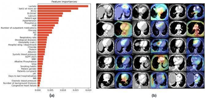 This composite educational graphic illustrates the interpretability of a multimodal machine learning model for pulmonary embolism (PE) risk stratification. (a) A horizontal bar chart displays 'Feature Importances' from Electronic Health Record (EHR) data. Key clinical features contributing to model prediction include lactate levels, SaO2 at room air, PCO2, D-Dimer, calcium, patient age, and hypertension. (b) A 5x6 grid presents diagnostic interpretability through Grad-CAM visualizations. It pairs axial 2D slices from 3D Computed Tomography Pulmonary Angiograms (CTPA) with corresponding heatmaps. These heatmaps utilize a color gradient (red/yellow/green indicating high activation) to highlight anatomical regions prioritized by the model for classification. Predominant activation occurs within cardiothoracic structures, including the pulmonary trunk, right and left ventricles, aorta, inferior vena cava, and general heart area. This demonstrates the model's focus on physiologically relevant hemodynamic and vascular markers for determining PE severity and associated 30-day mortality risk.