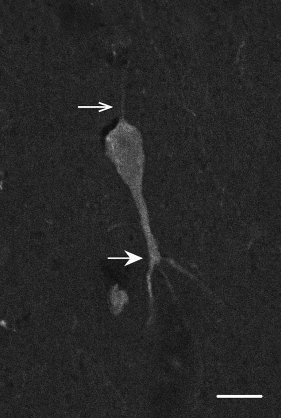 This diagnostic image is a high-magnification fluorescence micrograph showing a single calbindin-D28k-immunoreactive neuron within layer V of the primate cerebral cortex. The cell exhibits a dark, uniform staining pattern against a lighter background, characteristic of inhibitory interneurons. The morphology is defined by a distinct cell body with two primary types of processes. A thin axon (indicated by an open white arrow) extends superiorly toward the pial surface. In contrast, a thick, prominent primary dendrite (indicated by a closed white arrow) descends inferiorly toward the white matter, showing its first branching point at a distance from the soma. This morphological orientation resembles specific infragranular neuron populations. The image includes a 10 µm scale bar in the bottom right corner for dimensional reference. This visual material is used in neuroanatomy and histopathology to demonstrate laminar-specific neuronal morphology and calcium-binding protein expression.