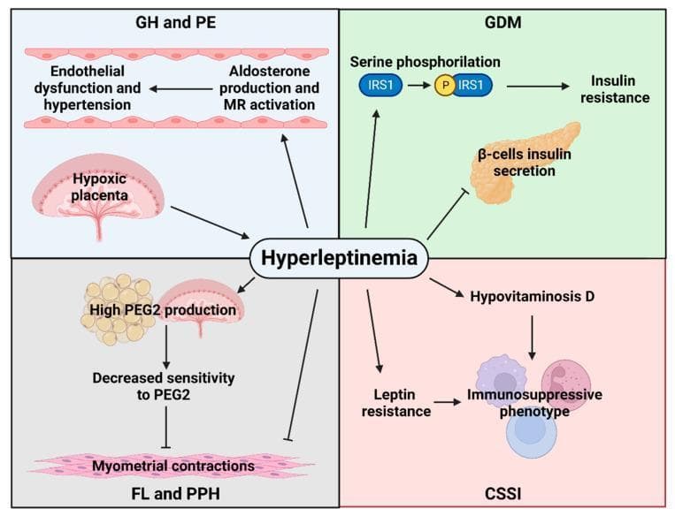 A pathophysiology diagram illustrating the central role of hyperleptinemia in the development of maternal obstetric complications, divided into four quadrants by condition. 1) GH and PE (Gestational Hypertension and Pre-eclampsia): Hyperleptinemia is linked to placental hypoxia and increased aldosterone production/MR activation, leading to endothelial dysfunction and hypertension. 2) GDM (Gestational Diabetes Mellitus): The diagram shows hyperleptinemia inducing serine phosphorylation of IRS1, leading to insulin resistance, while simultaneously inhibiting beta-cell insulin secretion. 3) FL and PPH (Failed Labor and Postpartum Hemorrhage): Hyperleptinemia stimulates high PGE2 production from adipose tissue and the placenta, which correlates with decreased sensitivity to PGE2 and subsequent inhibition of myometrial contractions. 4) CSSI (C-section Surgical Site Infection): Hyperleptinemia contributes to hypovitaminosis D and leptin resistance, both resulting in an immunosuppressive phenotype. Arrows indicate stimulatory pathways, while T-bars represent inhibitory actions, providing a comprehensive overview of hormonal and molecular signaling in obese pregnancies.