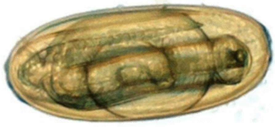 This diagnostic micrograph displays an embryonated egg of the nematode Nematodirus battus, a clinically significant helminth. The image captures the parasite in a late developmental stage, specifically featuring a well-developed third-stage larva (L3) coiled within the egg shell. The egg is characterized by a distinctive large, oval shape and a smooth, translucent outer shell. Internally, the larva is clearly visible as a complex, elongated, and folded structure with a segmented, textured appearance, occupying a significant portion of the internal volume. This 'larvated' stage is a critical diagnostic marker in parasitology, indicating maturity and readiness for hatching. Such images are used in medical and veterinary parasitology to identify species-specific egg morphology and to assess the life cycle progression of strongyle-type parasites in environmental or clinical specimens.