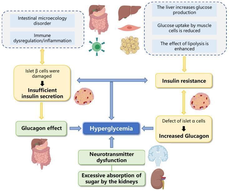 A pathophysiology diagram illustrating the multi-factorial mechanisms leading to hyperglycemia, particularly in the context of Type 2 Diabetes Mellitus. The diagram features a central blue box labeled 'Hyperglycemia' with various upstream contributing pathways. On the left, a pathway originates from 'Intestinal microecology disorder' and 'Immune dysregulation/inflammation,' leading to damage of pancreatic islet β-cells and subsequent 'Insufficient insulin secretion.' On the right, a multi-organ pathway involving the liver (increased glucose production), muscle (reduced glucose uptake), and adipose tissue (enhanced lipolysis) leads to 'Insulin resistance.' Additionally, a 'Defect of islet α-cells' is shown resulting in 'Increased Glucagon.' The bottom of the diagram includes 'Neurotransmitter dysfunction' (represented by a brain icon) and 'Excessive absorption of sugar by the kidneys' (represented by a kidney icon) as further contributing factors. Arrows indicate the flow of physiological dysfunctions that converge to elevate blood glucose levels. The diagram is designed as an educational tool for understanding the metabolic and endocrine drivers of diabetes.