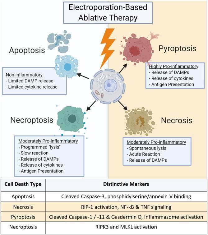 This pathophysiology diagram illustrates the four primary types of cell death initiated by electroporation-based ablative therapy: Apoptosis, Pyroptosis, Necroptosis, and Necrosis. A central cell subjected to an electrical pulse branches into these distinct pathways, categorized by their inflammatory impact and biochemical markers. Apoptosis is described as non-inflammatory with limited DAMP and cytokine release, characterized by cleaved Caspase-3 and annexin V binding. Pyroptosis is highly pro-inflammatory, involving Caspase-1/-11, Gasdermin D, and inflammasome activation, leading to cytokine release and antigen presentation. Necroptosis is a moderately pro-inflammatory, programmed lysis involving RIPK3 and MLKL activation. Necrosis is a moderately pro-inflammatory, spontaneous lysis involving RIP-1, NF-kB, and TNF signaling. The visual contrasts the morphology of each type, from the organized blebbing of apoptosis to the violent rupture of pyroptosis and the acute disintegration of necrosis. A summary table provides a quick reference for the distinctive molecular markers associated with each cellular subroutine, emphasizing the clinical relevance of selecting specific death pathways for effective tumor treatment and immune response modulation.