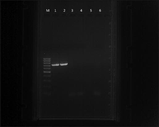 Diagnostic diagnostic image showing agarose gel electrophoresis of Polymerase Chain Reaction (PCR) products used for detecting Theileria annulata. The image consists of seven lanes. Lane M contains a 100 bp DNA ladder (marker) with multiple distinct bands of varying intensities used for fragment size estimation. Lane 1 displays a sharp, bright band at approximately 721 bp, serving as the positive control for T. annulata. Lane 2 shows a similar bright band at the same vertical migration level, indicating a positive clinical sample. Lanes 3, 4, and 5 contain negative clinical samples, showing no visible amplification bands. Lane 6 represents the negative control and is devoid of bands, confirming the absence of reagent contamination. This visual demonstrates molecular diagnostic techniques in infectious disease, specifically identifying the presence of parasitic DNA in biological samples through targeted primer amplification and size-based separation.