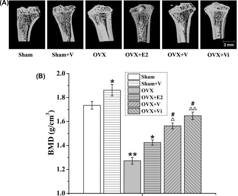 This composite image evaluates the impact of Low-Magnitude Vibration (LMV) and estrogen (E2) on bone mineral density (BMD) in a rat model of postmenopausal osteoporosis. Panel (A) presents micro-CT sectional views of the left proximal tibiae across six experimental groups: Sham, Sham+V (vibration), OVX (ovariectomized), OVX+E2, OVX+V, and OVX+Vi (immediate vibration). Visually, the OVX group shows significant trabecular bone loss and reduced density compared to Sham controls. The OVX+V and OVX+Vi groups demonstrate partial restoration of trabecular architecture, appearing superior to the OVX+E2 group. Panel (B) provides a corresponding bar graph measuring BMD in g/cm³. Statistical significance is noted relative to the Sham group (*, **), the OVX group (Δ, ΔΔ), and the OVX+E2 group (#). The data indicates that while ovariectomy significantly reduces BMD, LMV—particularly when initiated early (Vi)—effectively mitigates bone loss, showing higher efficacy in preserving bone mass and structural integrity than traditional estrogen treatment in this preclinical model.