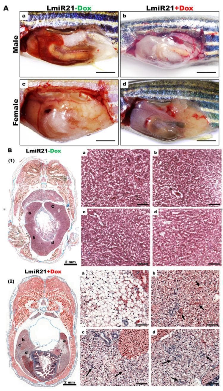 This composite image presents a preclinical study of nonalcoholic steatohepatitis (NASH) using a zebrafish model (LmiR21). Section A displays gross clinical photographs comparing livers from control (LmiR21-Dox) and experimental (LmiR21+Dox) groups at 6 months post-fertilization (mpf). In both males and females, the miR-21 induced livers (+Dox) appear enlarged, pale red, and greasy, consistent with hepatomegaly and steatosis. Section B provides histopathological analysis using Masson’s trichrome staining. The control liver (B1) shows normal hepatic architecture and cellularity. In contrast, the miR-21 overexpressing liver (B2) exhibits hallmark NASH phenotypes, including extensive hepatocyte ballooning (a), increased Mallory-Denk bodies (b, arrows), and significant lobular inflammation (c, d, arrows). These histopathological features demonstrate the progression from simple steatosis to steatohepatitis and early fibrosis, evidenced by blue-stained collagen deposition. This image serves as a translational model for understanding the role of microRNA-21 in hepatic lipid metabolism, inflammation, and fibrogenesis.