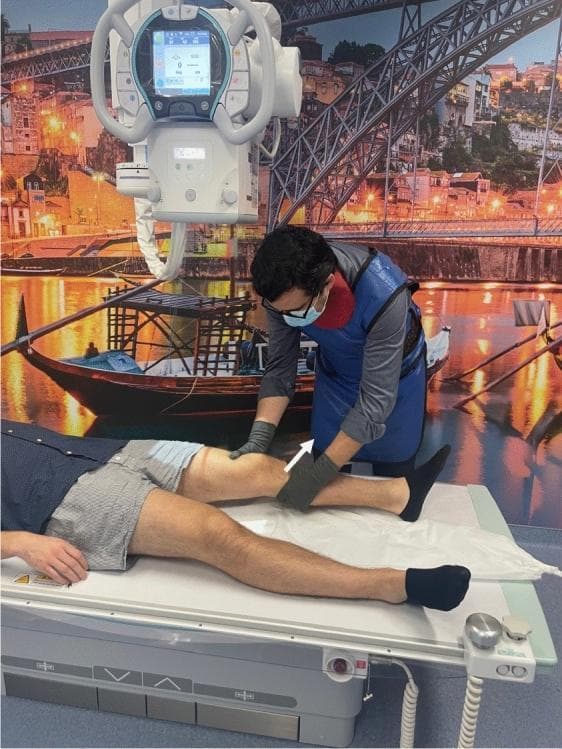 A clinical photograph and diagnostic setup showing a physician performing the Lachman test manually for stress radiography. The patient is in a supine position on a radiolucent examination table. The physician, wearing a lead apron, protective gloves, and a mask, is positioned beside the patient's right knee. One hand is placed on the distal femur to stabilize the leg, while the other hand is positioned on the proximal tibia. A white arrow indicates the anterior translatory force applied to the tibia relative to the femur, a maneuver used to assess the integrity of the Anterior Cruciate Ligament (ACL). Above the patient's knee, a digital X-ray tube head with a control display is positioned to capture the joint laxity under stress. This clinical scenario demonstrates the integration of physical examination maneuvers with medical imaging to objectively quantify knee instability and ligamentous laxity.