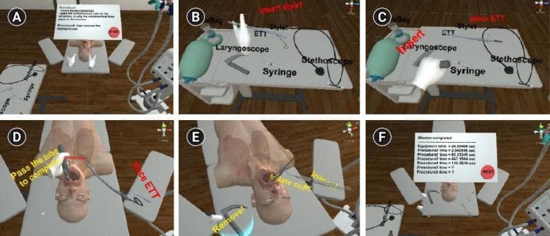 A series of six panels (A-F) from a virtual reality (VR) medical training simulation focused on endotracheal intubation. (A) Shows the overall virtual clinical environment with a patient mannequin and instructional interface. (B & C) Focus on the equipment table, labeling essential airway management tools: Bag Valve Mask (Ambu Bag), laryngoscope with a curved blade (Macintosh type), endotracheal tube (ETT), stylet, syringe for cuff inflation, and stethoscope. In panel C, a virtual hand demonstrates inserting the stylet into the ETT. (D & E) Depict the clinical procedure on the mannequin. In (D), the laryngoscope is used to visualize the airway while the ETT is passed into the trachea. In (E), the laryngoscope is removed, and a syringe is used to inflate the ETT distal cuff to secure the airway and prevent aspiration. (F) Displays a summary screen of procedure times for performance assessment. This instructional content is designed for medical training in airway management, anesthesia, or emergency medicine, demonstrating the chronological steps of preparing equipment, intubation, and cuff management.