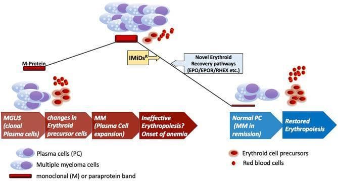 A pathophysiology diagram illustrating the disease progression of monoclonal gammopathy of undetermined significance (MGUS) to multiple myeloma (MM) and the subsequent impact on erythropoiesis. The visual follows a peak-like trajectory: the left side shows the progression from MGUS (clonal plasma cells) to MM (plasma cell expansion), characterized by a thickening M-protein band and increasingly ineffective erythropoiesis leading to anemia. At the peak, malignant multiple myeloma cells dominate the bone marrow environment alongside sparse red blood cells and erythroid precursors. The downward right slope depicts therapeutic intervention using immunomodulatory drugs (IMiDsR) and the engagement of novel erythroid recovery pathways involving EPO, EPOR, and RHEX. This phase represents MM in remission (Normal PC) and the clinical restoration of erythropoiesis, visualized by the return of mature red blood cells and normal erythroid precursor levels. Key components include plasma cells, monoclonal (M) paraprotein bands, and the sequential maturation stages of the erythroid lineage.